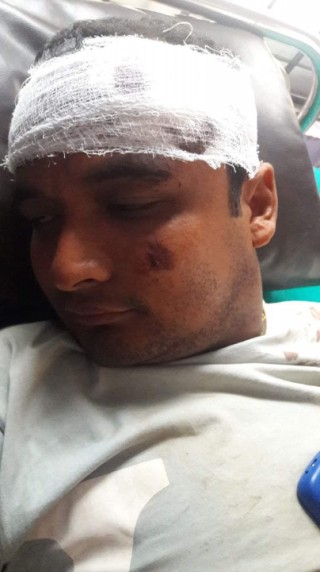 गोरखा भीमसेन गाउँपालिकाका सवइन्जिनियरले कुटे निर्माण व्यवसायी नवराज लामिछानेलाई
