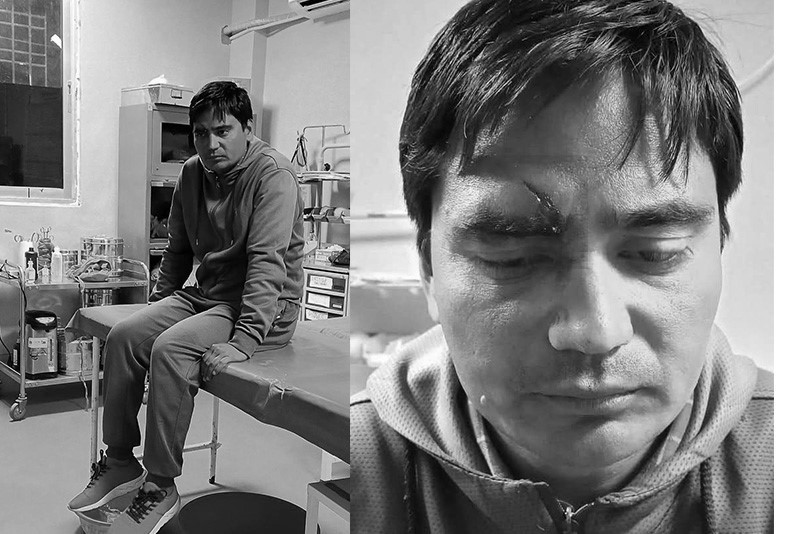 नेपाल पत्रकार महासंघ बझाङका अध्यक्षमाथि चक्कु प्रहार